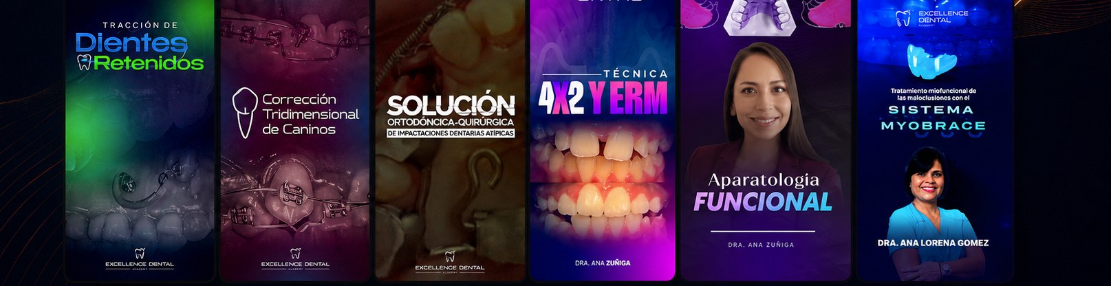 Cursos de la ruta Ortodoncia en Niños y Dientes Impactados